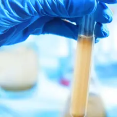 Ręka w niebieskiej rękawiczce trzyma probówkę z mętnym płynem, być może badając obecność nh4.